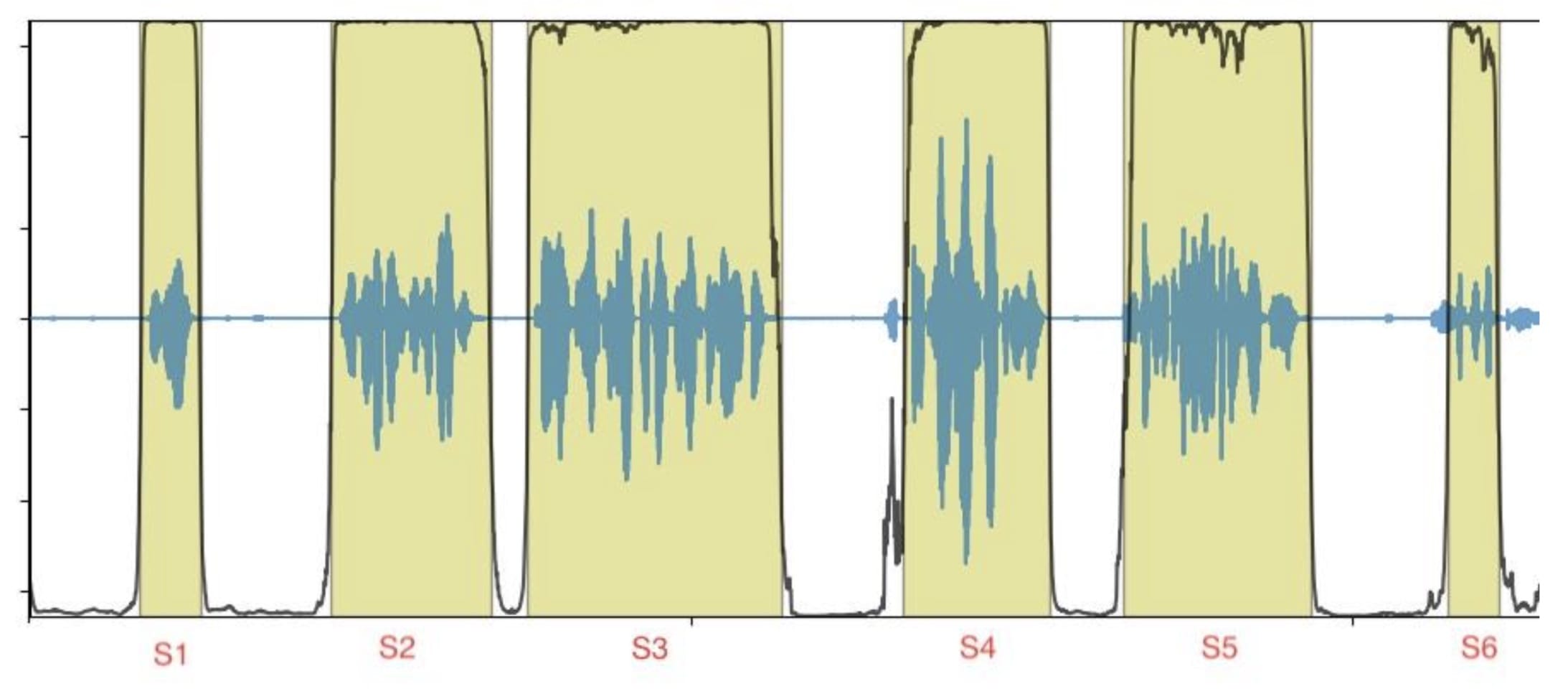 Figure 1: Example audio file with segment boundaries